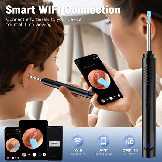Wireless Smart Visual Earwax Remover with Camera